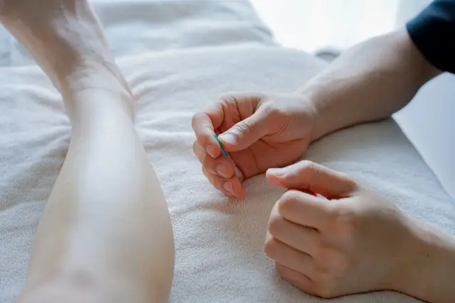 鍼灸院治療風景