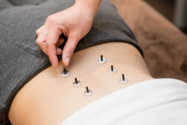 鍼灸院の治療風景